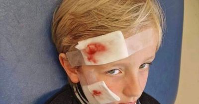 Boy, seven, needs 12 stitches in face after dog attack in pet shop
