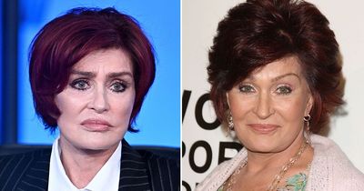 Sharon Osbourne quits plastic surgery for good after horrendous 'cyclops' facelift