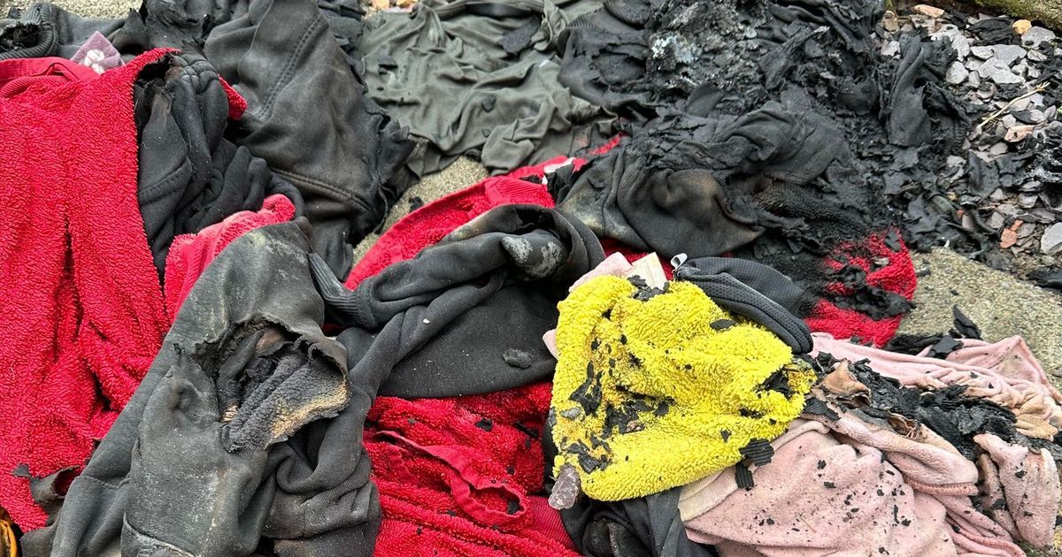 Scots mum issues warning after her clothes catch fire…