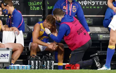 AFL culture around concussion must change, inquiry told