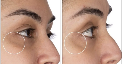 'Brilliant' £16 eye cream makes dark circles vanish in four weeks, beauty reviews say