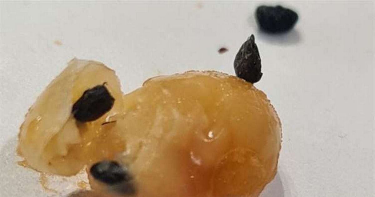 Boy, 6, finds weevils in Lidl baked beans after his…