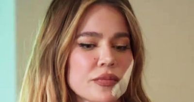 Khloe Kardashian shows off huge facial scar as she reveals cancer scare