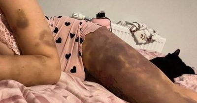 Young mum beaten 'black and blue' wrote goodbye letter to son after horrific abuse from thug ex