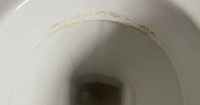 Mrs Hinch fans hail unusual £2 hack to get rid of stubborn toilet limescale