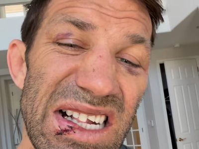 Former UFC champion Luke Rockhold cracks tooth in bare knuckle boxing match