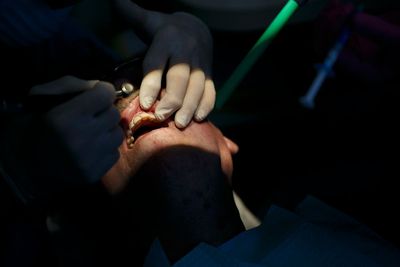 Low-income New Yorkers win the right to a root canal