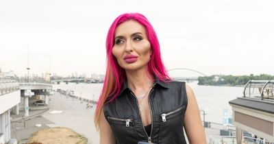 Model with 'world's biggest cheeks' candidly shares what she looked like before filler