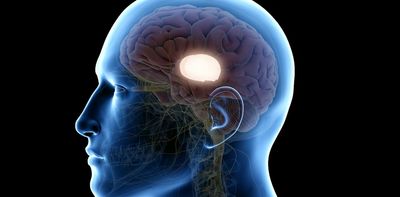 Concussion: almost half of people still show signs of brain injury after six months