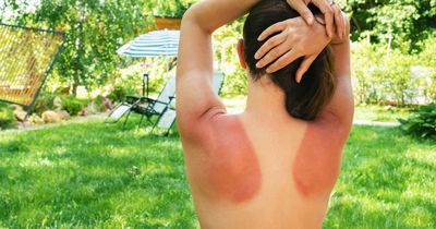 Dire skin cancer warning to Scots urged to wear sunscreen - even while in the UK