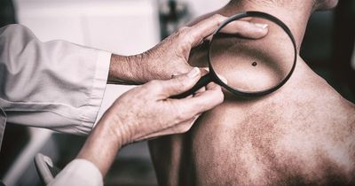 Signs and symptoms of skin cancer everyone needs to be on the lookout for
