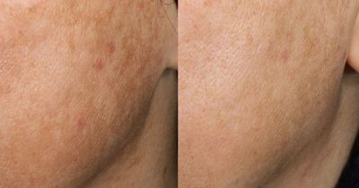 Medik8 customers 'swear by' brightening serum after 'rapid anti-ageing results'