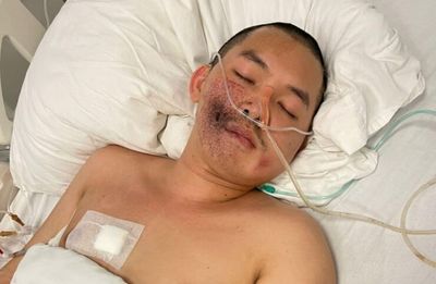 Shot Lao activist confirmed to be still alive