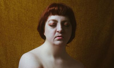 A moment that changed me: I was bullied over my cleft palate – but found confidence as a life model