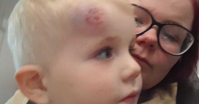 Two-year-old boy hit so hard by cyclist he was knocked out of his shoes