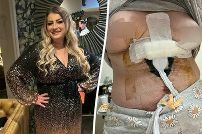 Woman needed eight life-saving operations after Turkey tummy tuck: ‘I’m not the person I was’