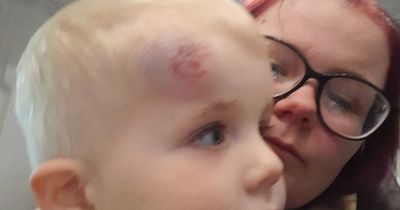Boy, 2, 'hit by cyclist and dragged along street' in front of mum on school run