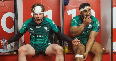 Mack Hansen shows off gruesome injury suffered in Connacht's win over Ulster