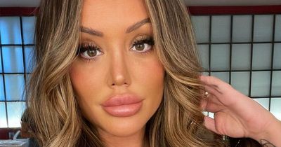 Charlotte Crosby shares 'ridiculous' snaps of biggest pout after ditching filler for good