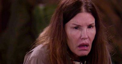 ITV I'm A Celebrity Janice Dickinson's exit statement in full after being rushed to hospital