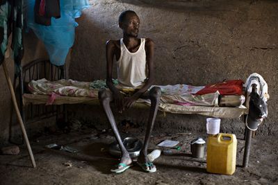 Tuberculosis rates rocket amid Ukraine, Sudan conflicts