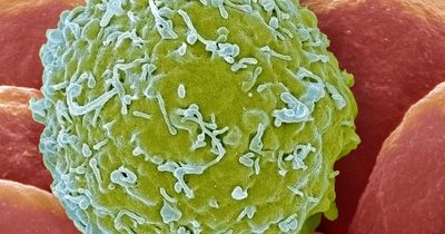 Four blood cancer red flags you should never ignore