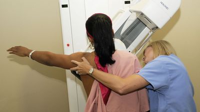 Women should start getting mammograms at 40 not 50, health panel recommends