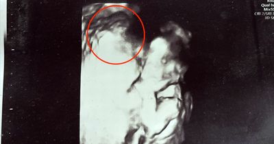 Mum spots 'Virgin Mary holding baby' in scan moments after being told tot had died