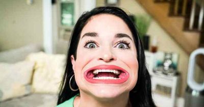 Woman with world's biggest mouth hits back at cruel trolls calling her 'frog girl'