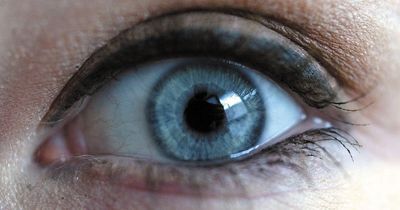 'Silent' high cholesterol symptom you can spot in your eyes