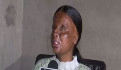 Acid attack survivor, a peon's daughter, tops in school with 95 per cent in CBSE Class 10 exams