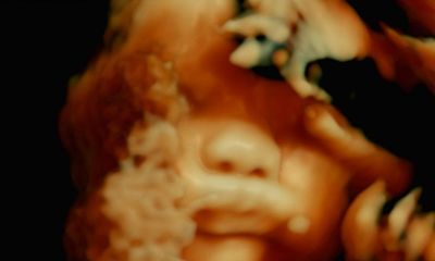 De Humani Corporis Fabrica review – gruesome surgery film gets under the skin