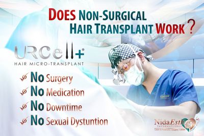 Does non surgical hair transplant work? Behind cosmetic surgery by Dr.Piya
