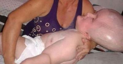 Baby born with expanding head that won't stop growing due to rare condition