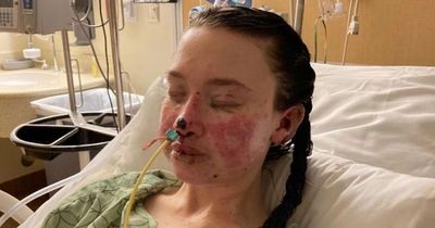 Woman's skin begins to 'burn from inside' after potentially fatal reaction to anxiety meds