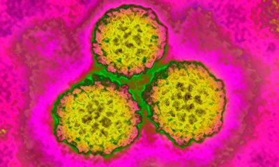 Microwave device could be less invasive treatment for HPV-caused cancers
