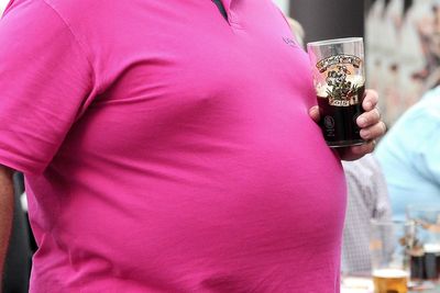 Obese patients cost NHS double the amount of healthy people