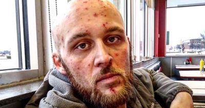 'Opioid zombie' dad from 'overdose capital of US' transforms after getting clean