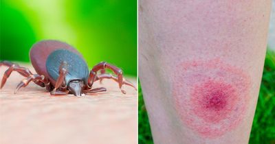 Lyme disease warning as tick season in full force with VERY unwelcome 'lone star' visitor