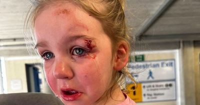 Dad pulls daughter out of nursery after she's left needing hospital treatment