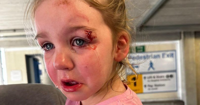 Dad pulls daughter out of nursery after accident leaves her with traumatic eye injury