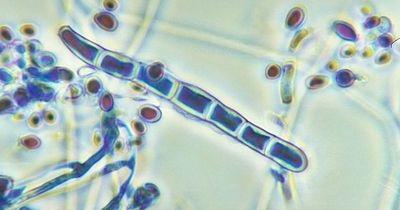 Health experts warn 'world not prepared' as women infected with contagious disease