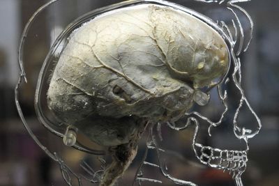 Brain signals can predict how much pain a person is in, research suggests