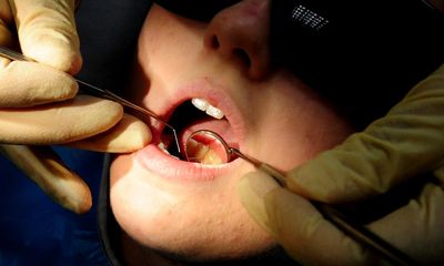 NHS dentist numbers in England at lowest level in a decade