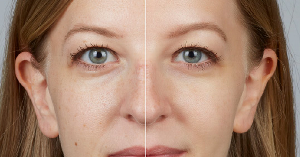 'Boots £10 antiwrinkle cream gives such drastic…