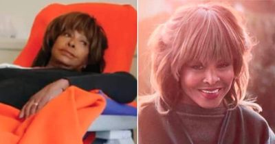 Tina Turner's scary health struggle as not even organ donated by husband could save her
