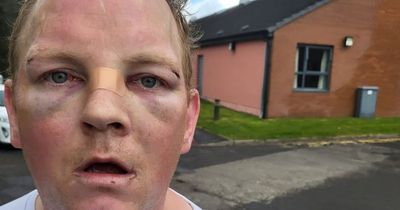 Dad slams Glasgow NHS after son beaten black and blue with pool cue in hospital