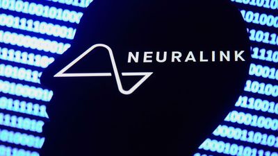 Elon Musk’s Brain Chip Company Gets FDA Greenlight For ‘First-In-Human Clinical Study’