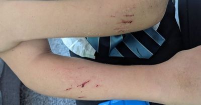 Boy, 11, 'left covered in blood by school bullies slicing him with glass shard'