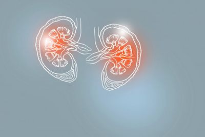 High creatinine levels can indicate chronic kidney disease